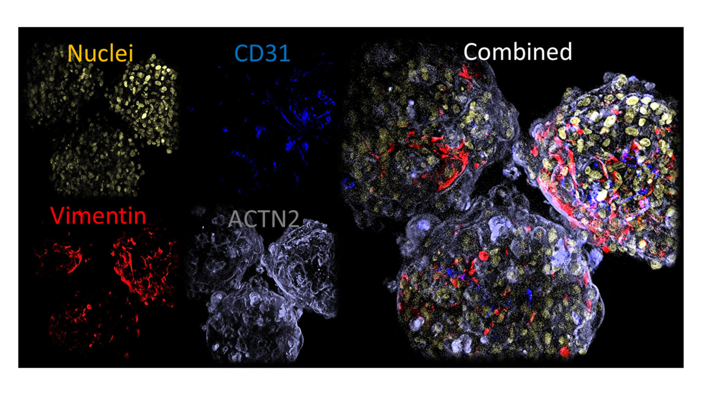 Cardiotoxicity fig 2