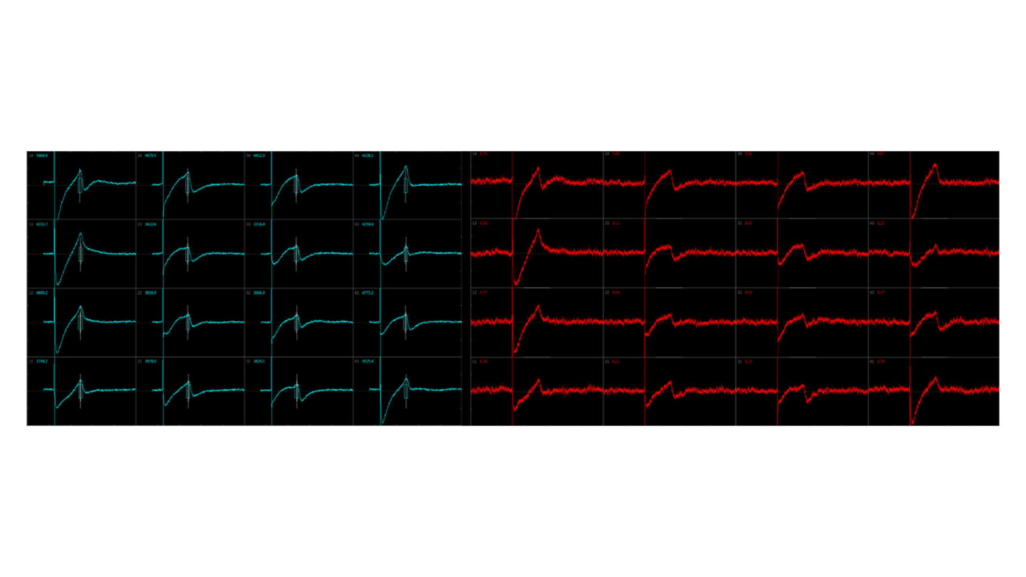 Cardiotoxicity fig 3