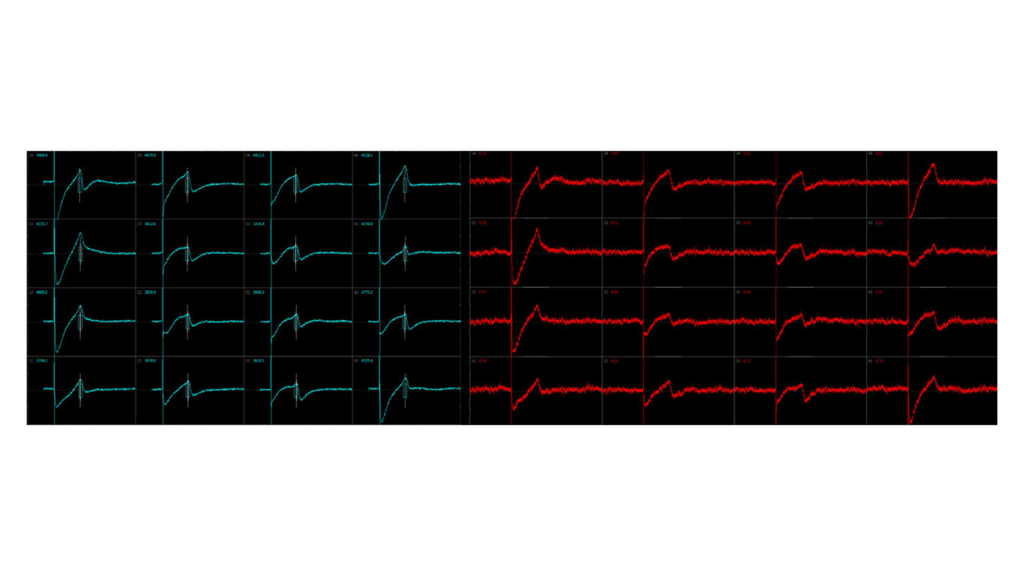 Cardiotoxicity fig 3