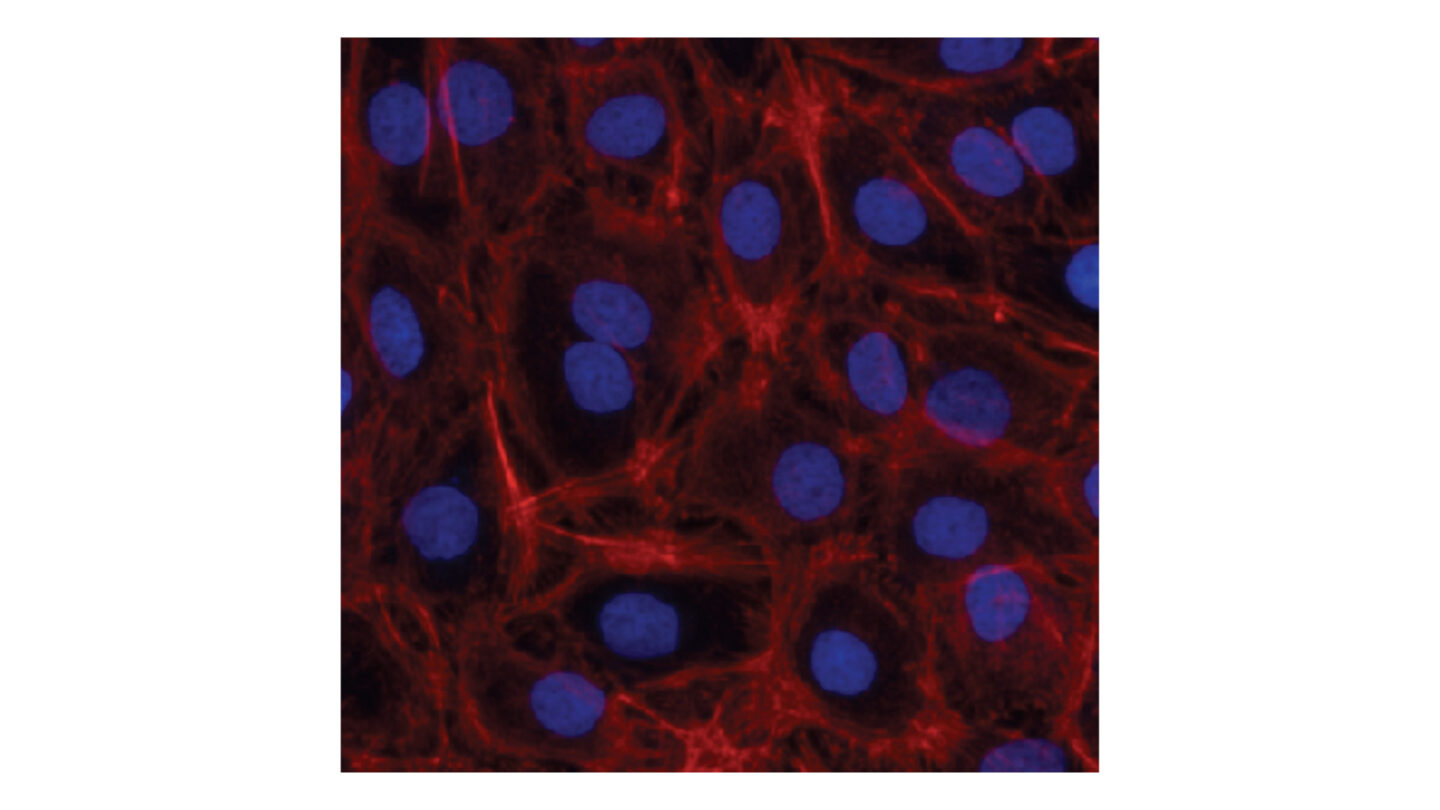 Keratinosens fig 1