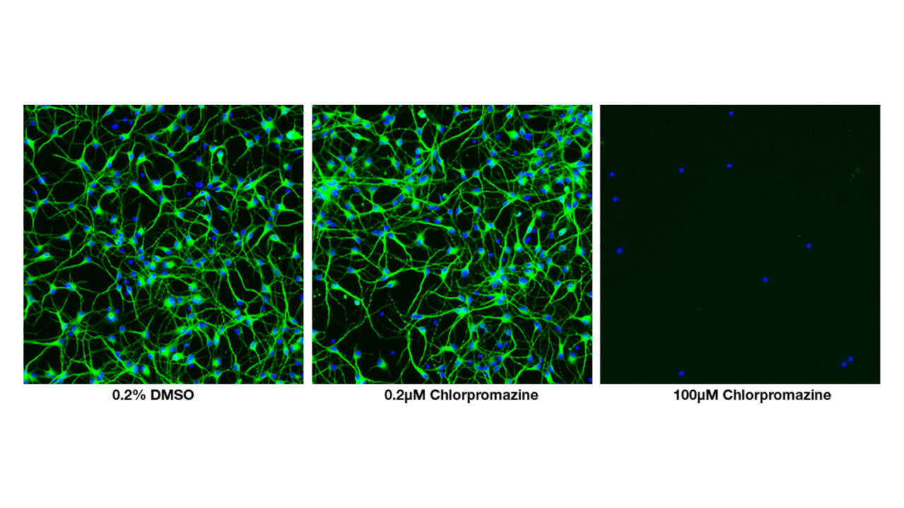 Neurite Outgrowth Assay | Cyprotex ADME-Tox Solutions - Evotec