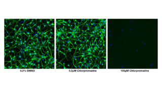 Cyprotex Injection Neurite Outgrowth Assay | Cyprotex ADME-Tox Solutions - Evotec