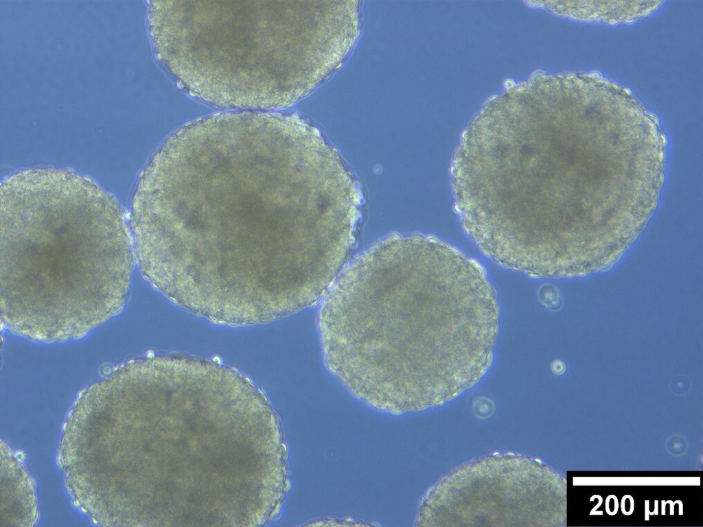 Microscope image of round cell spheroids on a blue background, with a 200 µm scale bar.