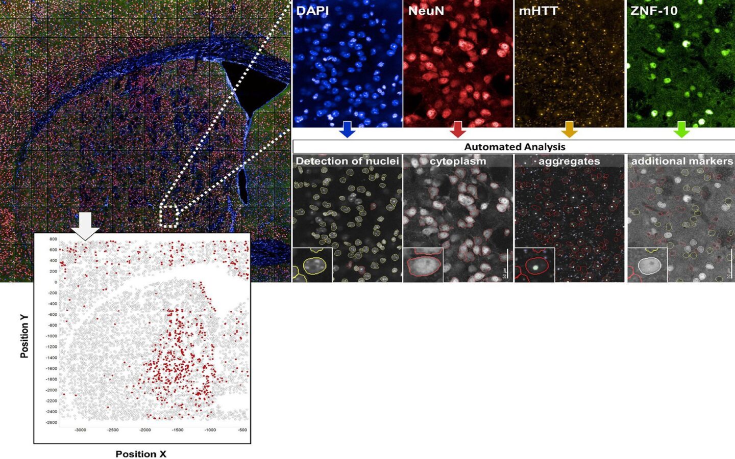 Rare Diseaes Mutant Huntington Aggregate Analysis