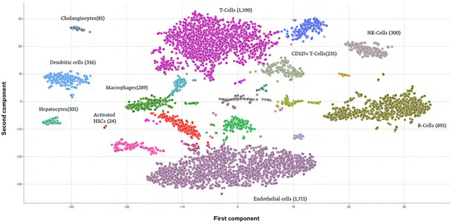 Illustration of automated AI driven cell type annotation for clusters of liver sc RN Aseq cells