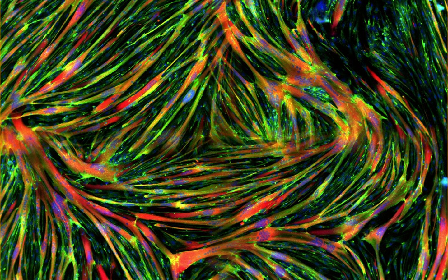 In Vitro Biology Metabolic Diseases Complications