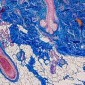 Skin sensitization CYP
